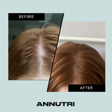 Load image into Gallery viewer, Annutri Grow it hair supplements