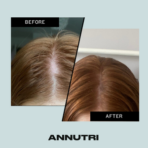 Annutri Grow it hair supplements